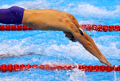 WHY ARE SOME OLIMPIANS ‘CUPPING’?